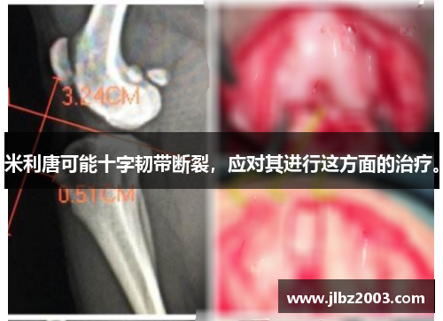 米利唐可能十字韧带断裂，应对其进行这方面的治疗。